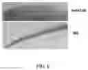 Fig. 07 - Immunogenic proteins against 