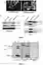 Fig. 03 - Lentiviral vector-based Japanese encephalitis immunogenic composition