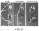Fig. 09 - TRIGGERABLE HYDROGEL COMPOSITIONS AND RELATED METHODS