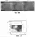 Fig. 11 - TRIGGERABLE HYDROGEL COMPOSITIONS AND RELATED METHODS