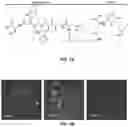 Fig. 02 - Castration resistant prostate cancer