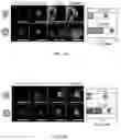 Fig. 04 - Artificial antigen-presenting cells and methods for producing and using the same