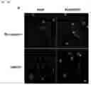 Fig. 07 - Biodegradable biomimetic particles