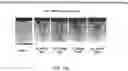 Fig. 17 - Particles comprising bilirubin derivative and metal