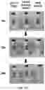 Fig. 24 - Particles comprising bilirubin derivative and metal