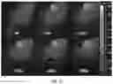 Fig. 26 - Particles comprising bilirubin derivative and metal