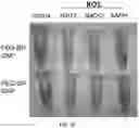 Fig. 33 - Particles comprising bilirubin derivative and metal