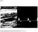 Fig. 04 - COMPOSITION FOR IMPROVING ULTRASONIC TRANSMISSION EFFICIENCY, GEL COMPOSITION FOR ULTRASONIC DIAGNOSIS, AND ULTRASOUND IMAGING METHOD
