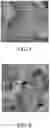 Fig. 02 - NANO-OXIDE/KAOLIN COMPOSITE HEMOSTATIC ANTIBACTERIAL MATERIAL, HEMOSTATIC HEALING-PROMOTING DRESSING AND PREPARATION METHOD THEREOF