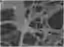 Fig. 01 - Biological tissue matrix material, preparation method therefor and use thereof in otological repair material