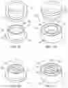 Fig. 08 - Drug Eluting Implant
