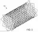 Fig. 03 - DRUG-ELUTING MEDICAL IMPLANTS