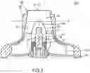 Fig. 04 - VENTRICULAR ASSIST BLOOD PUMP