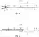 Fig. 02 - VA ECMO with pulmonary artery ventilation