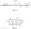 Fig. 03 - VA ECMO with pulmonary artery ventilation