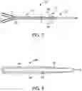 Fig. 05 - VA ECMO with pulmonary artery ventilation