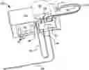 Fig. 01 - Systems for performing peritoneal dialysis