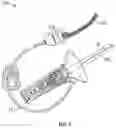 Fig. 02 - Intravenous device with integrated sensors