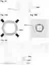 Fig. 20 - Accessory device for drug delivery device