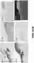 Fig. 07 - Gaseous nitric oxide delivery system and methods of use