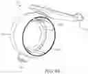 Fig. 40 - Oscillating positive expiratory pressure device