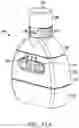 Fig. 51 - Oscillating positive expiratory pressure device