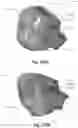 Fig. 103 - Respiratory mask system