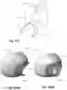 Fig. 104 - Respiratory mask system