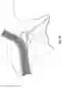 Fig. 11 - Respiratory mask system