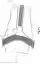 Fig. 16 - Respiratory mask system