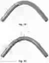 Fig. 19 - Respiratory mask system