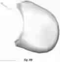 Fig. 46 - Respiratory mask system