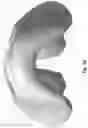 Fig. 47 - Respiratory mask system