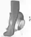 Fig. 53 - Respiratory mask system