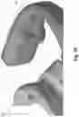 Fig. 64 - Respiratory mask system