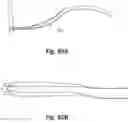 Fig. 79 - Respiratory mask system