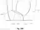 Fig. 93 - Respiratory mask system