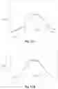 Fig. 97 - Respiratory mask system