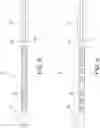 Fig. 05 - Catheter with movable indicator