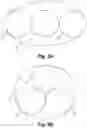Fig. 03 - Bi-lateral catheter system and methods for use