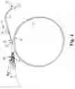 Fig. 04 - Bi-lateral catheter system and methods for use