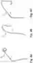 Fig. 05 - Bi-lateral catheter system and methods for use