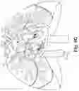 Fig. 10 - Bi-lateral catheter system and methods for use