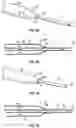 Fig. 10 - Catheter delivery device and related systems and methods