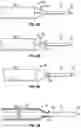 Fig. 11 - Catheter delivery device and related systems and methods