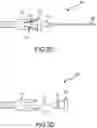 Fig. 04 - Catheter insertion device with tip protector housing