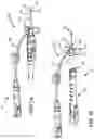 Fig. 02 - IV catheter with vein entry indication