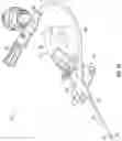 Fig. 02 - Confirmation of catheter placement within a vein