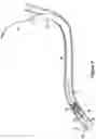 Fig. 05 - Double-ended wire guide and method of use thereof