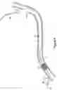 Fig. 06 - Double-ended wire guide and method of use thereof